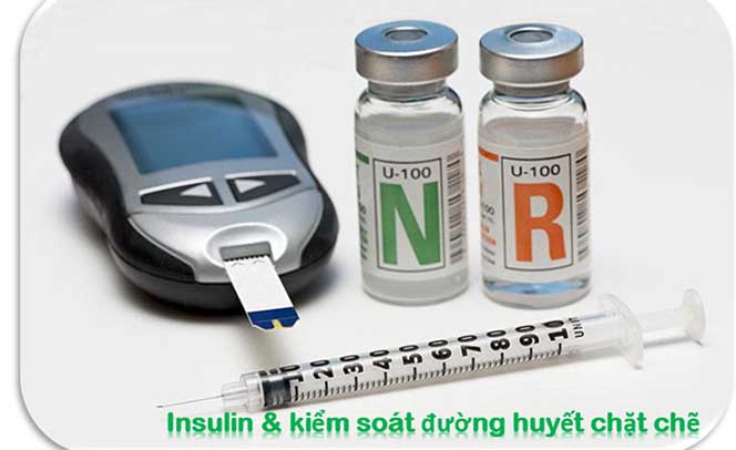 Insulin có mối quan hệ mật thiết với bệnh tiểu đường